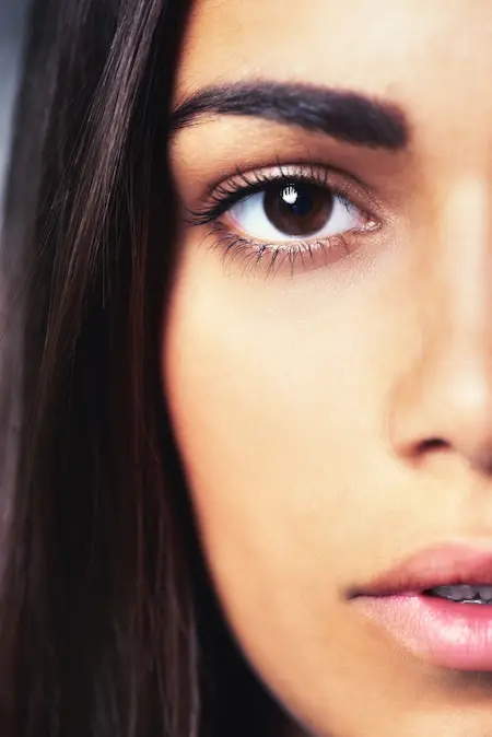 Blefaroplastia - Cirugia de párpados