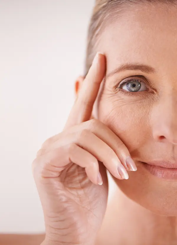 Eliminar patas de gallo con botox