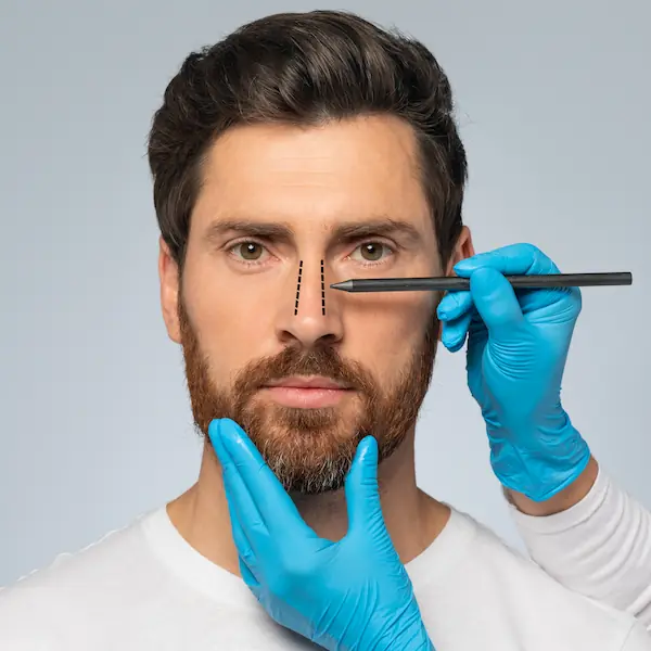 rinoplastia cirugia barcelona