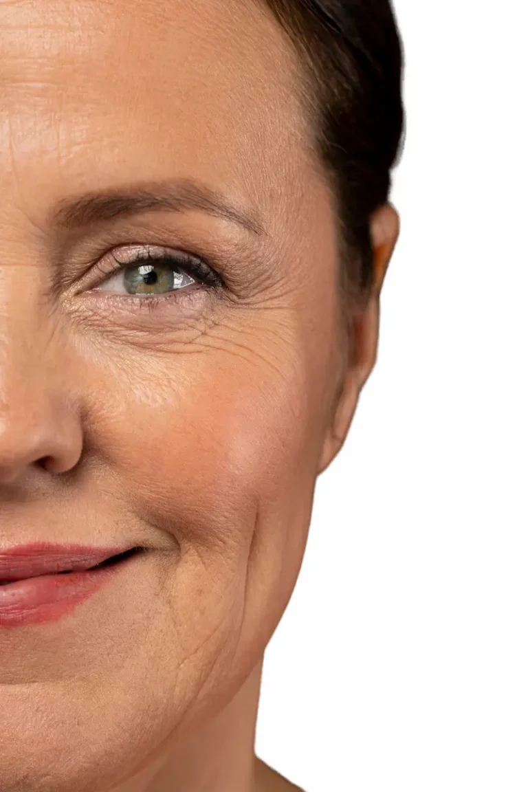 Rejuvenecimiento facial IDEFI